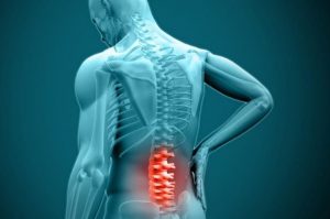 تشخیص فتق دیسک